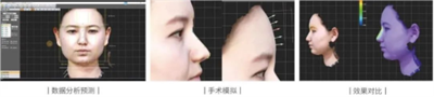 领智三维3D数字化轻医美 2023上海整形科技周精彩回顾703.png 领智三维3D数字化轻医美 2023上海整形科技周精彩回顾703.png
