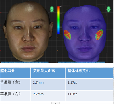 领智三维3D数字化轻医美 2023上海整形科技周精彩回顾1288.png 领智三维3D数字化轻医美 2023上海整形科技周精彩回顾1288.png